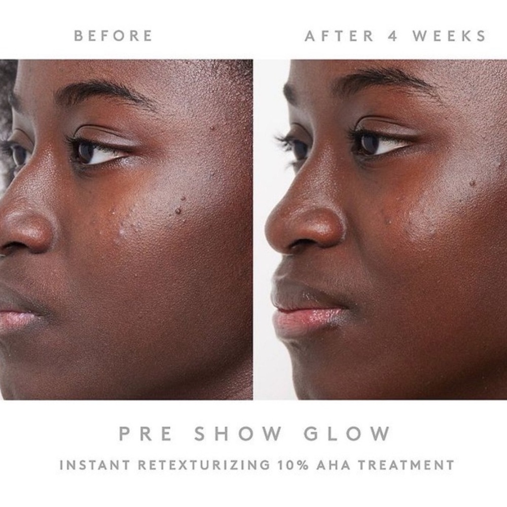 FENTY SKIN Pre-Show Glow Instant Retexturizing Treatment and Applicator - Picture 6 of 8